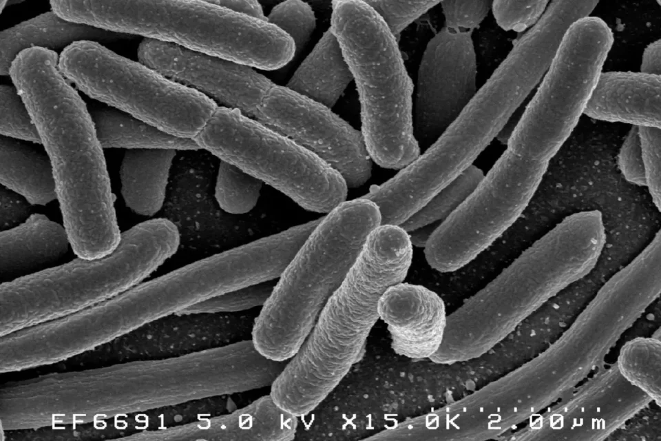 Pałeczki bakterii Coli